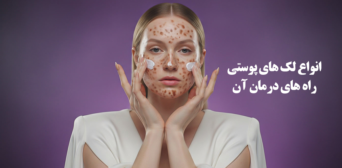 لک‌های پوستی و روش‌های درمان آن‌ها